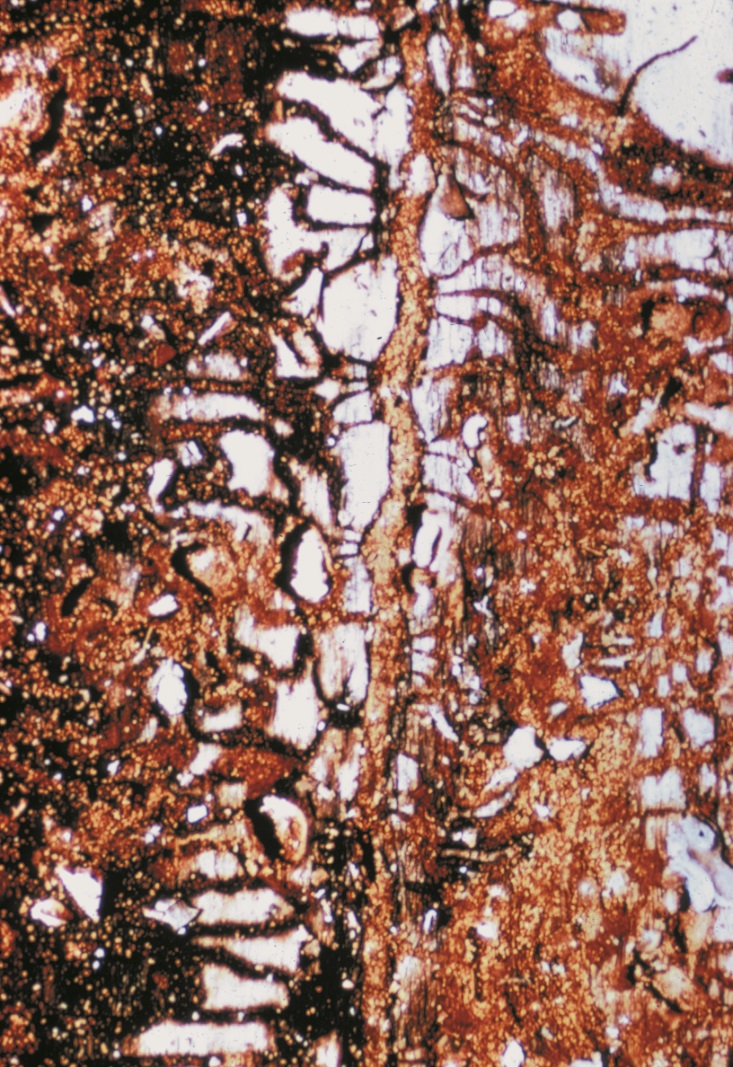 egg galleries